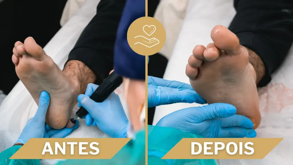 Balance Alvor - balancealvor blog pedicure alvor cortar unhas pes 2